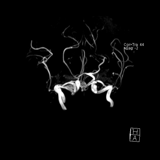 Click on the Serie image to view the images of VILLANUEVA, WILLIAM A.